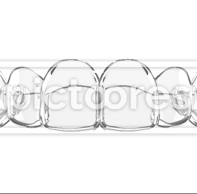 Removable and clear dental aligner