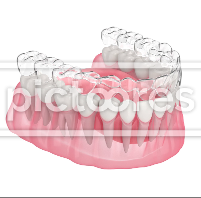 Clear invisalign aligner splint make toothing correction