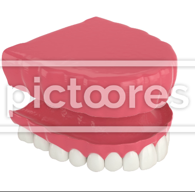 Removable traditional denture installation