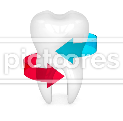 Tooth protection concept