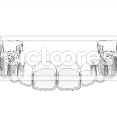 Clear orthodontic aligner
