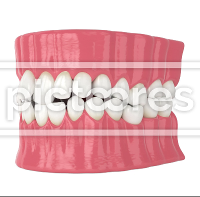 Straightening crooked teeth