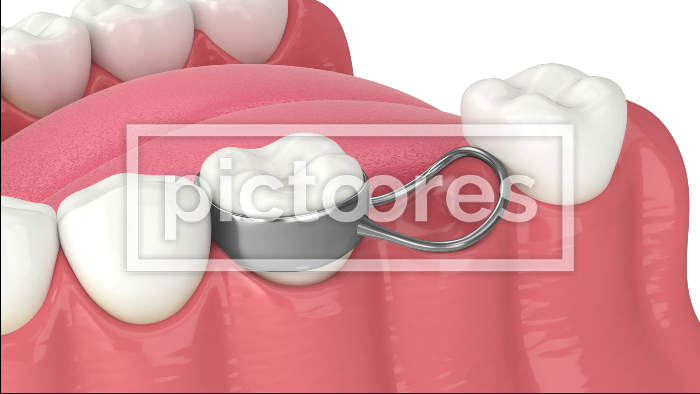 Tooth extraction and new tooth growth process