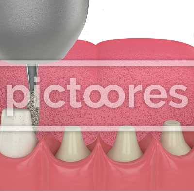Jaw with dental crowns embed on reshaped teeth