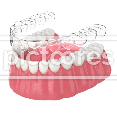 Clear aligner splint make bite correction