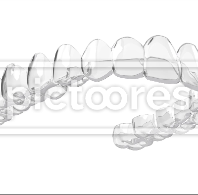 Clear removable dental aligner