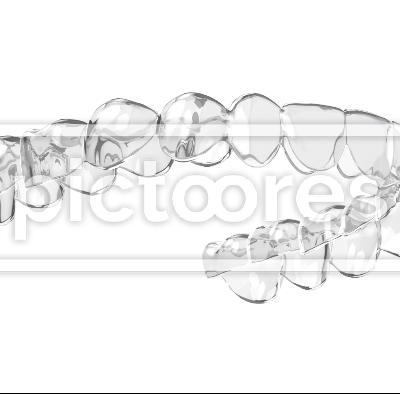 Clear removable lower dental aligner