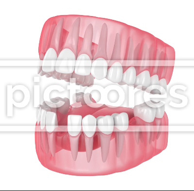 Translucent jaw with missing teeth