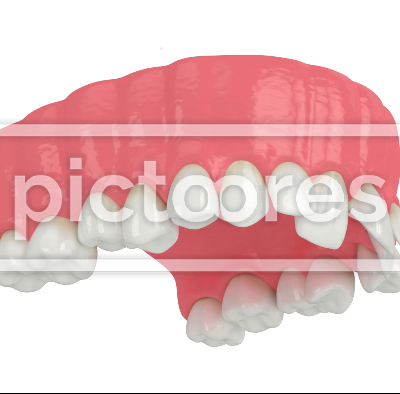 Upper jaw with abnormal teeth position
