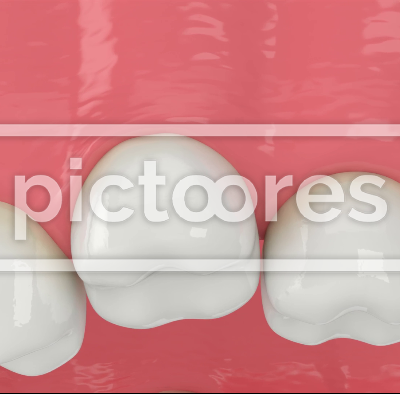 Closeup of upper jaw with abnormal teeth position