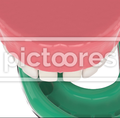 diastema treatment procedure