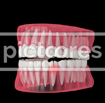 jaw with cracked tooth